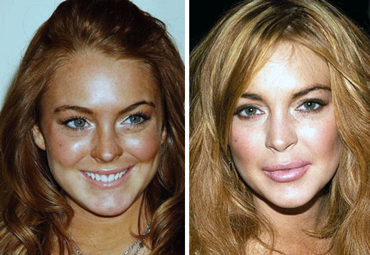 LOHAN