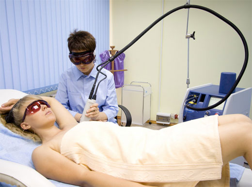 FOTODEPILACION LASER