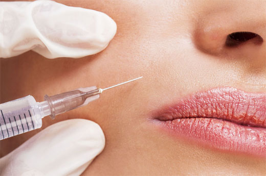 LABIOS