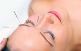 Acupuntura antiage