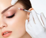 Aplicaes do plasma rico em plaquetas na medicina esttica